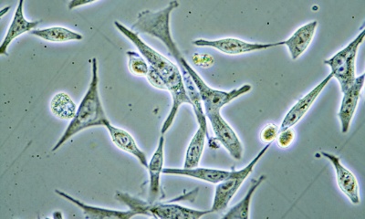 Prostate cancer cells
