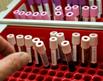 vials of blood awaiting testing