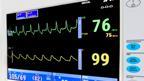 intensive care cardiac monitor medical machine
