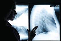 Lung X Ray