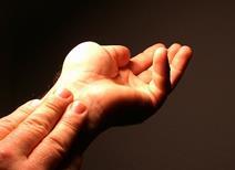 An arthitic hand
