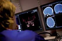 Urgent brain scan for stroke patients