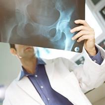 Doctor looking at pelvic Xray