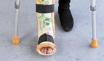 Womans leg in plaster