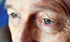 Older man, depressed