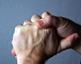 No arthritis care improvement since 2003 - MPs