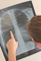Spearhead PCTs achieve limited success on cancer survival