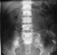 Prostate xray exam