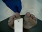 Dead body in morgue