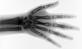 X-ray of hand
