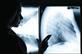 Xray of lungs