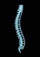 A single spine x-ray