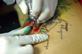 NHS Surrey stops funding for IVF and tattoo removal
