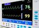 Heart monitor screen