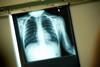 Updated: Trust's X-ray system down for days following 'major' IT failure